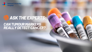 Can tumour markers really detect cancer?