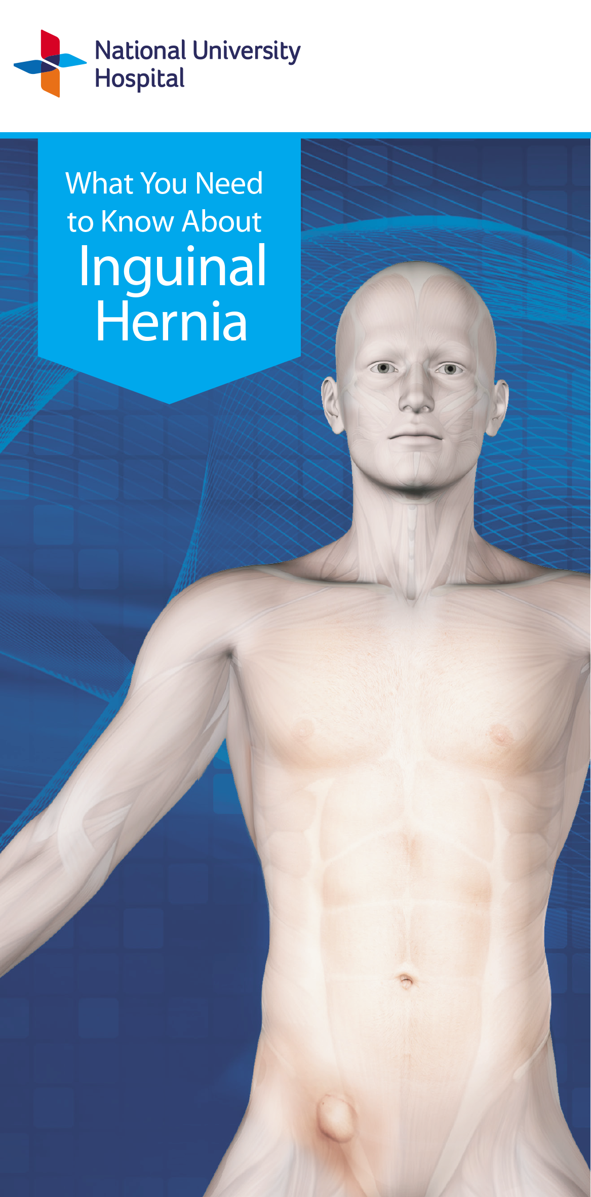 Brochure Inguinal Hernia