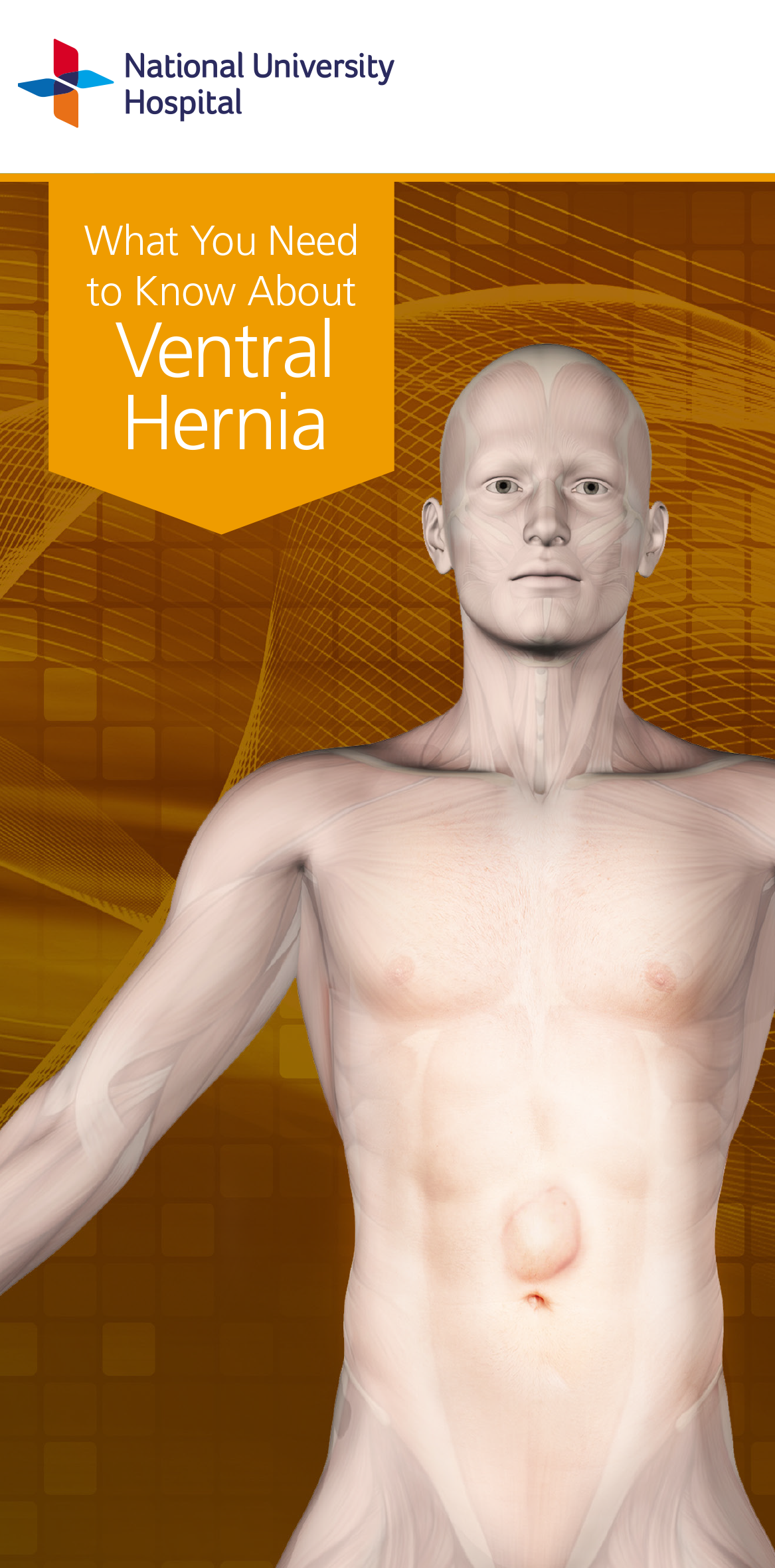 Brochure Ventral Hernia