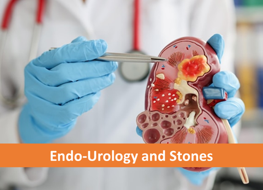 Endo-Urology and Stones