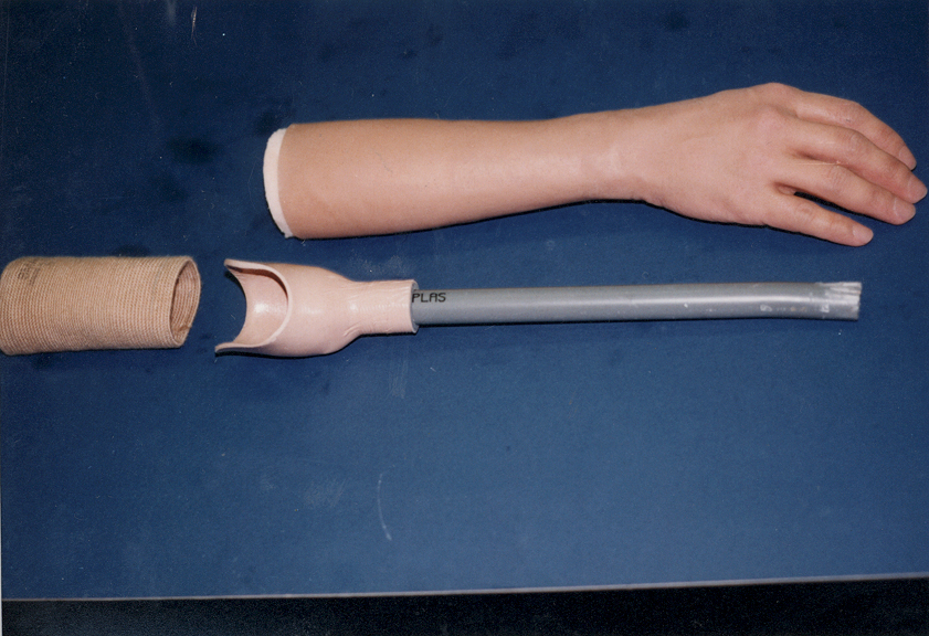 The components of a lightweight transradial (below-elbow) prosthesis