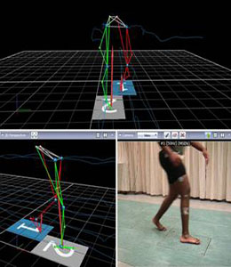 Lower limb analysis with synchronised video