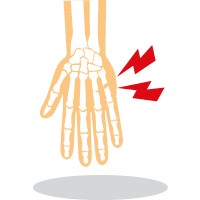 Hand Therapy (Fractures)