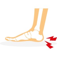 Heel Pain