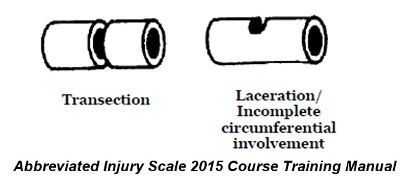 Transection and Laceration