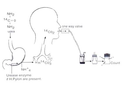 Urea breath test