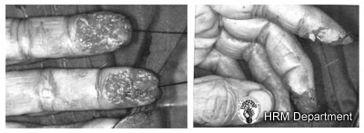 Upper and Lower Limb Traumas - Fig 2