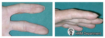 Upper and Lower Limb Traumas - Fig 3