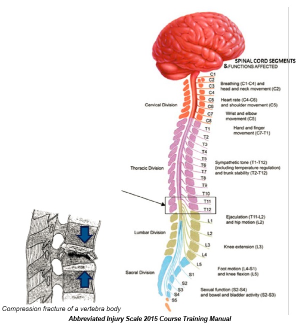 Spinal injuries