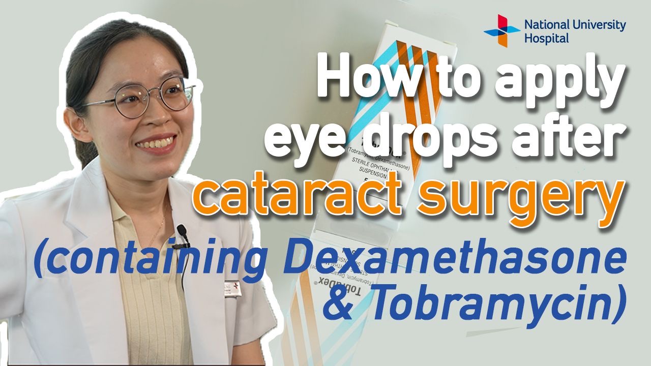 How to apply eye drops after cataract surgery